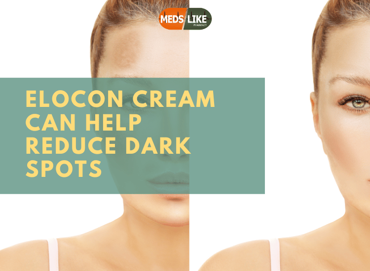 Elocon Cream