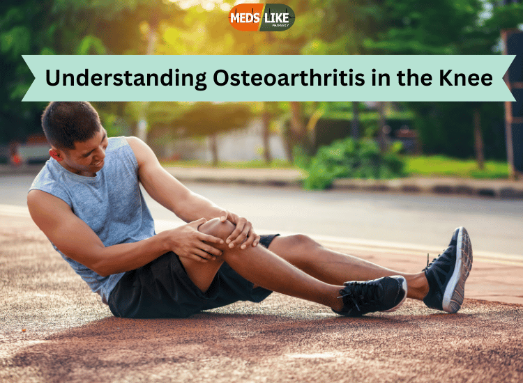 Osteoarthritis