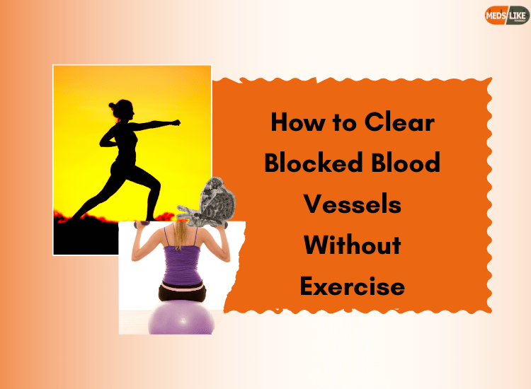 How to Clear Blocked Blood Vessels Without Exercise