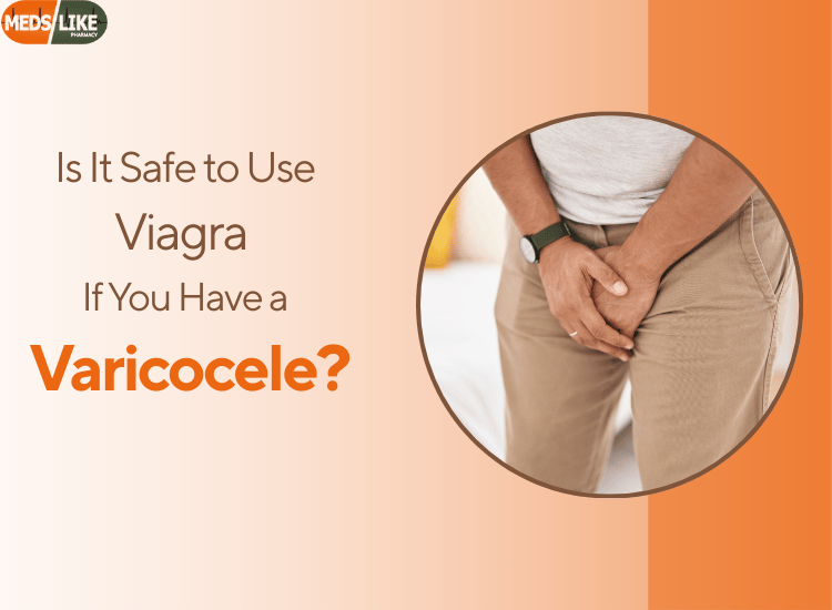 Varicocele