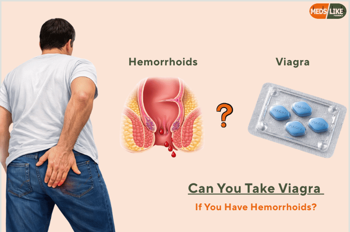 Can You Take Viagra If You Have Hemorrhoids