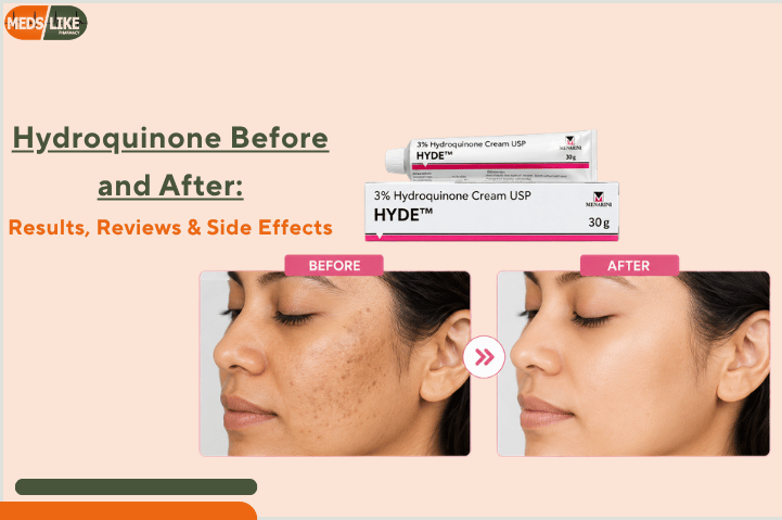 Hydroquinone Before and After