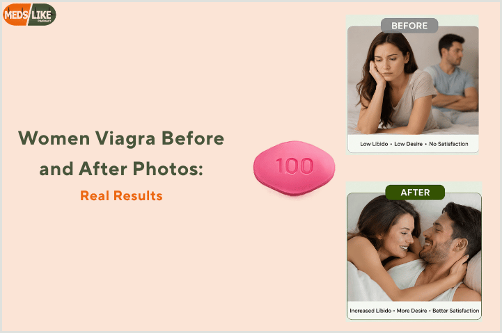 Women Viagra Before and After Photos