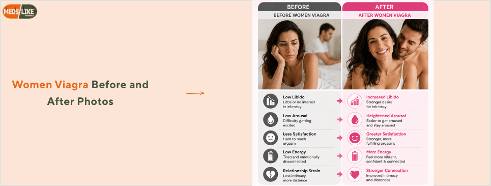 Women Viagra Before and After Photos