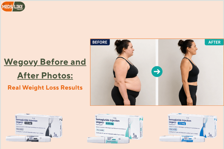 Wegovy Before and After Photos